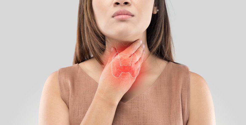 médecine fonctionnelle - Hypothyroïdie